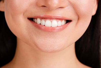 เผยรอยยิ้มมั่นใจ ฟอกสีฟัน คืออะไร อยู่ได้ไหม ?